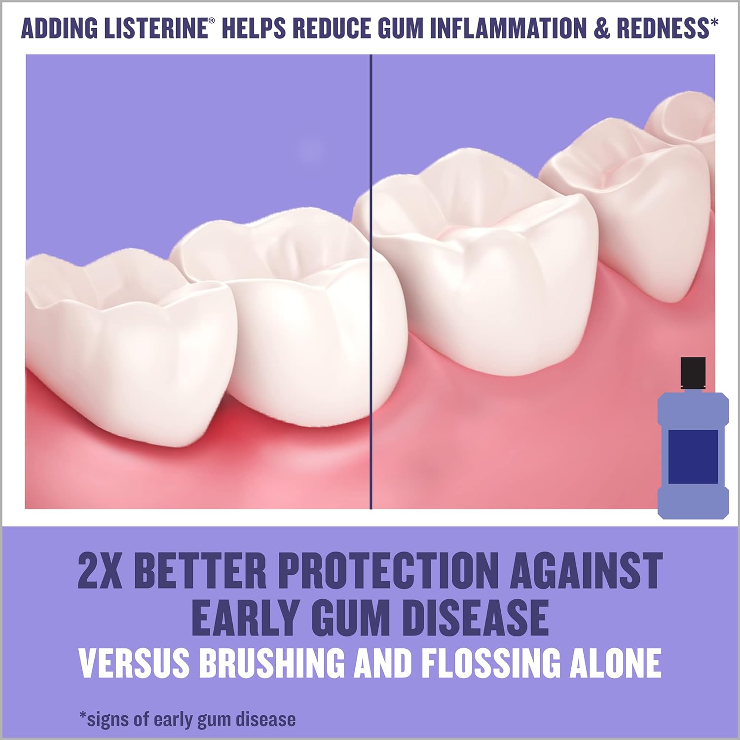 Listerine Total Care Antiseptic Mouthwash for Gingivitis and Teeth Plaque - Contains Thymol, Menthol, and Eucalyptol as Essential Oils - 1.5L, Purple