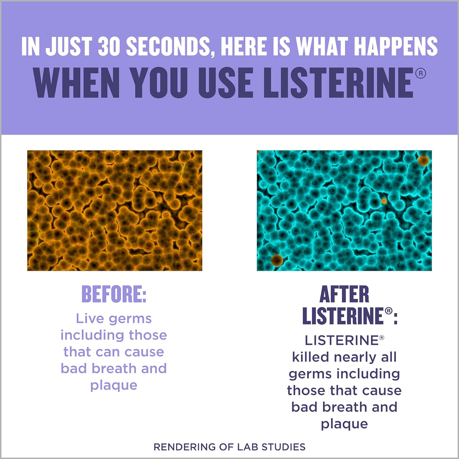 Listerine Total Care Antiseptic Mouthwash for Gingivitis and Teeth Plaque - Contains Thymol, Menthol, and Eucalyptol as Essential Oils - 1.5L, Purple