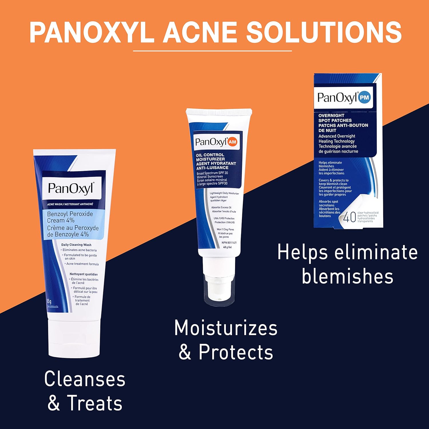 Creamy Acne Wash - 4% Benzoyl Peroxide