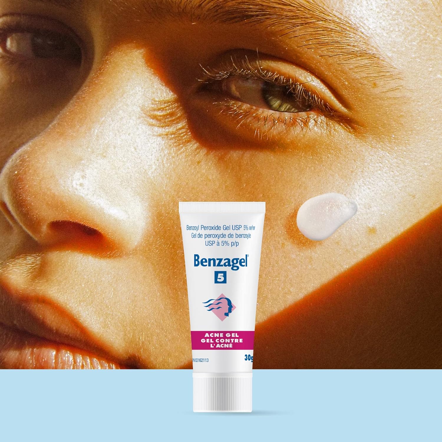 Benzagel Acne Gel, 30Gm