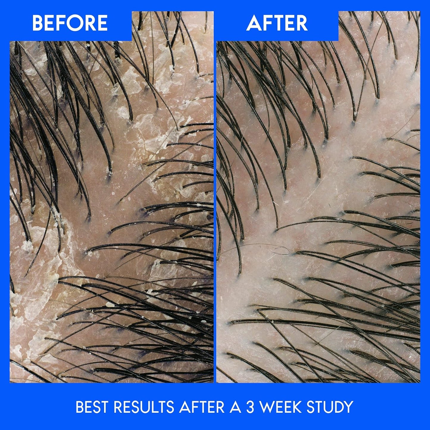 Head & Shoulders Green Apple 2-In-1 Shampoo + Conditioner, White,Green,Blue (835 ml).