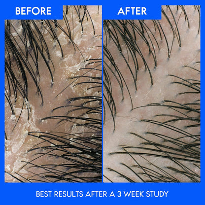 Head & Shoulders Green Apple 2-In-1 Shampoo + Conditioner, White,Green,Blue (835 ml).